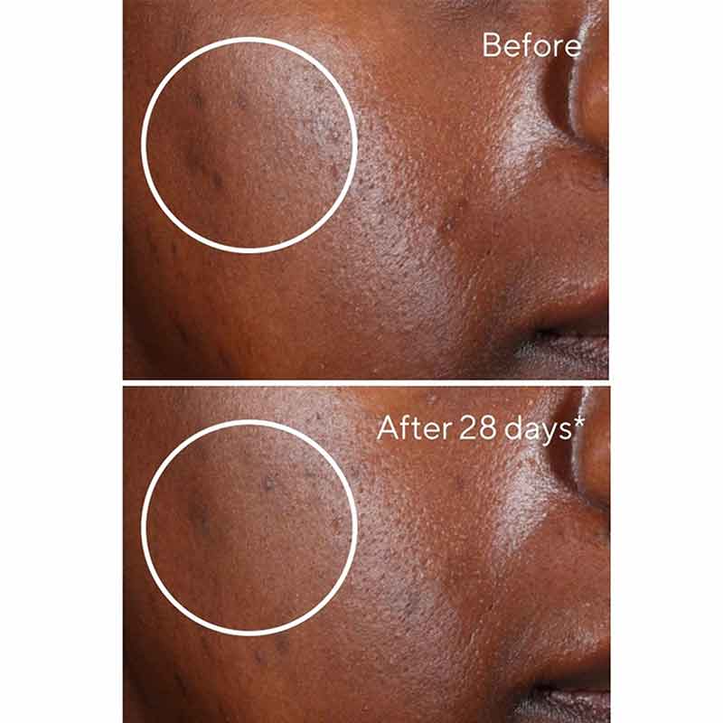 Murad Environmental Shield Rapid Dark Spot Correcting Serum