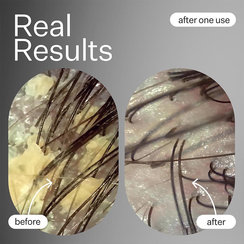 Act+Acre Cold Processed Scalp Detox Oil