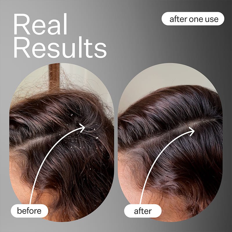 Act+Acre Cold Processed Scalp Detox Oil
