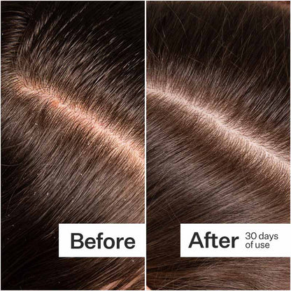 Act+Acre Microbiome Cooling Scalp Serum