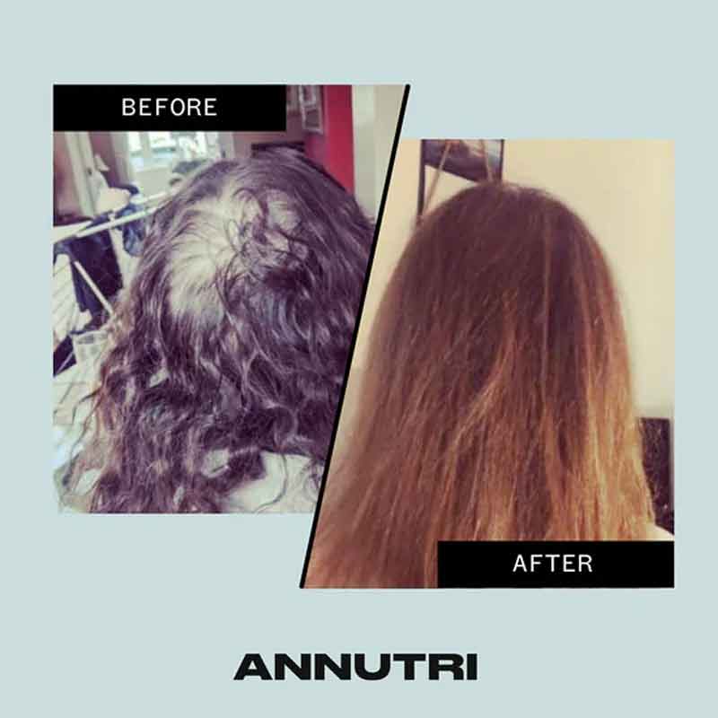 Annutri Grow It Hair Growth Supplement - 3 Month Supply