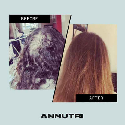 Annutri Grow It Hair Growth Supplement - 3 Month Supply