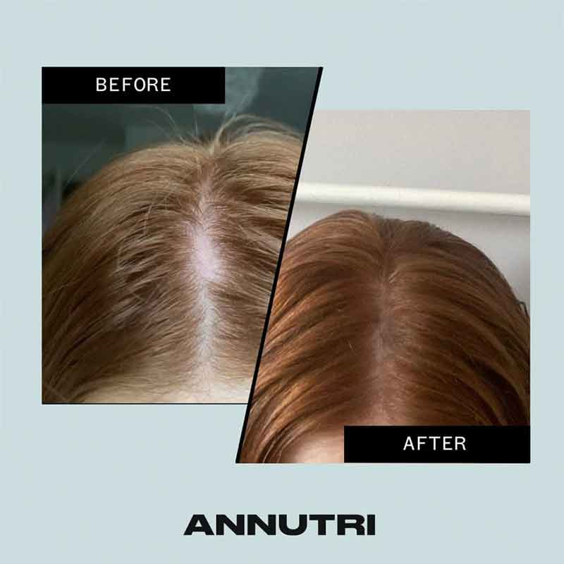 Annutri Grow It Hair Growth Supplement - 3 Month Supply