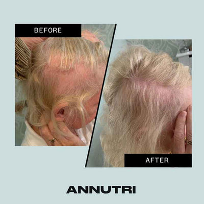 Annutri Grow It Hair Growth Supplement - 3 Month Supply