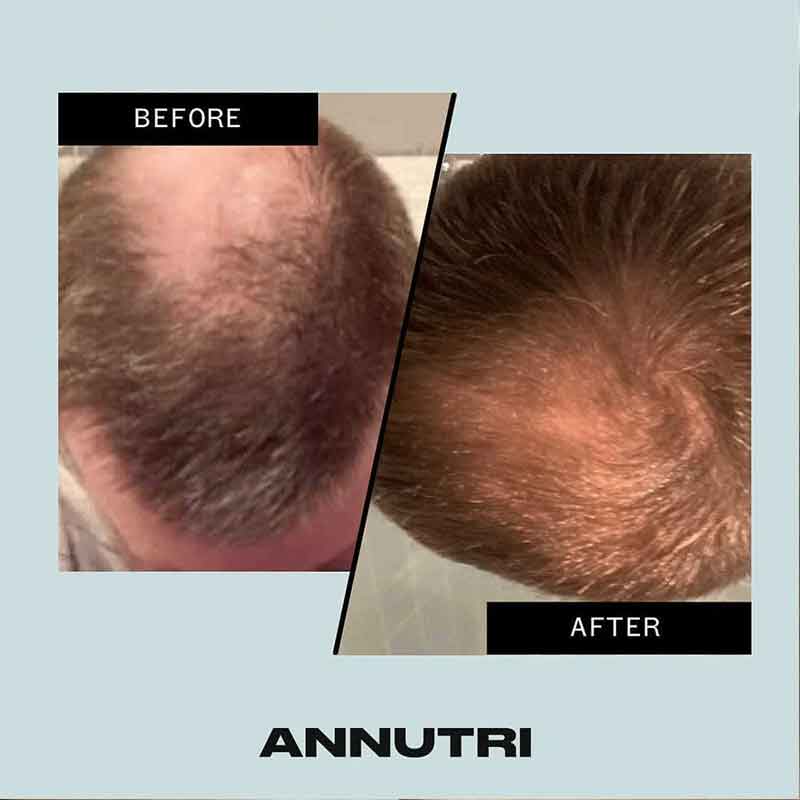 Annutri Grow It Hair Growth Supplement - 3 Month Supply