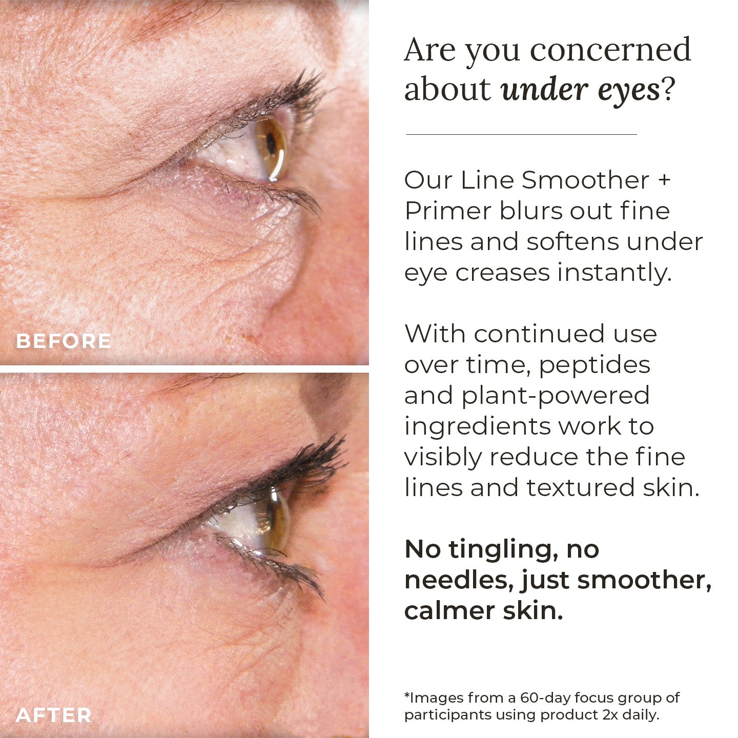 Amazing Cosmetics - Line Smoother + Primer with Neodermyl®