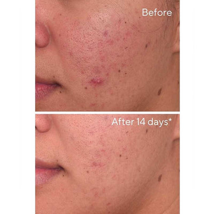 Murad Environmental Shield Rapid Dark Spot Correcting Serum