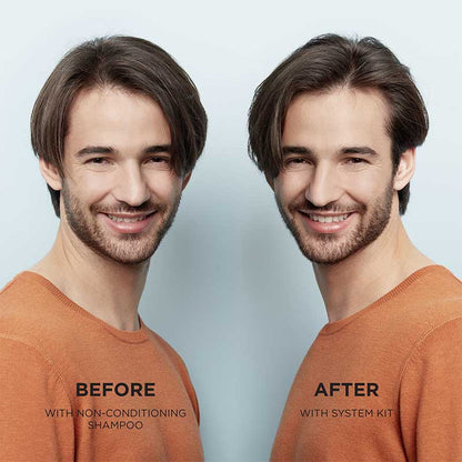 Nioxin System 1 Scalp & Hair Treatment