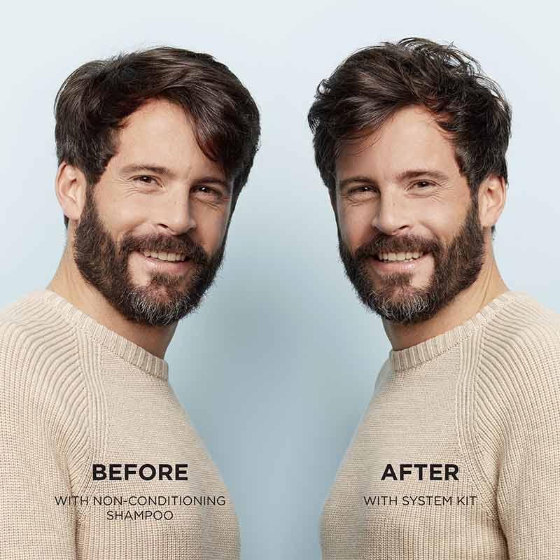 Nioxin System 1 Three Part Loyalty Kit for Light Thinning